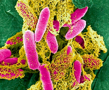 e_coli_o157h7.jpg
