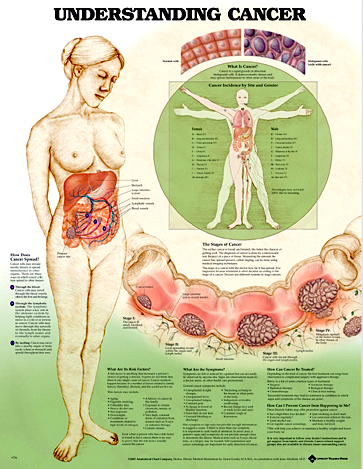 Cancer.jpg